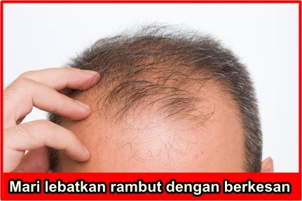 Rambut Leper & Nipis – Petua Untuk Lebih Kelantangan Secara Semulajadi